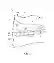 Fig. 02 - THERAPEUTIC MOUTHGUARD SYSTEM