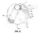 Fig. 08 - Paint roller skin cleaner