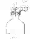 Fig. 18 - Pressure-regulating vial adaptors
