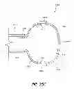Fig. 29 - Pressure-regulating vial adaptors