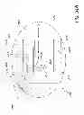 Fig. 40 - Pressure-regulating vial adaptors
