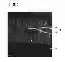 Fig. 04 - Negative electrode active material for secondary battery and method for producing the same