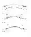 Fig. 02 - Method for producing an interior trim part of a vehicle
