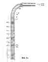 Fig. 02 - Method and apparatus for wellbore fluid treatment