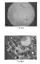 Fig. 09 - Methods for pre-sharpening impregnated cutting structures for bits, resulting cutting structures and drill bits so equipped