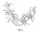 Fig. 04 - TWO PIECE CLIMBER APPARATUS
