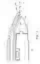 Fig. 15 - Distal tip features for end effector of surgical instrument