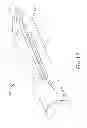 Fig. 21 - Distal tip features for end effector of surgical instrument