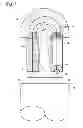Fig. 04 - Surgical stapler delivery systems and methods of assembling the staplers