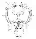 Fig. 05 - Pivot thrust reverser surrounding inner surface of bypass duct