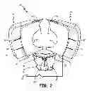 Fig. 04 - Tandem thrust reverser with sliding rails