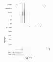Fig. 14 - Pixel Array With Global Shutter