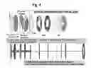 Fig. 05 - Micro-column with double aligner