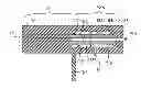 Fig. 01 - SYSTEM FOR MANUFACTURING A POLYMER ENDOPROSTHESIS BY INJECTION MOLDING AND BLOW MOLDING