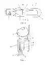 Fig. 02 - High-pressure discharge lamp having an ignition aid