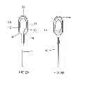 Fig. 03 - High-pressure discharge lamp having an ignition aid