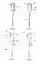 Fig. 04 - High-pressure discharge lamp having an ignition aid