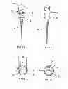 Fig. 05 - High-pressure discharge lamp having an ignition aid