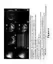 Fig. 06 - MR IMAGING USING SHARED INFORMATION AMONG IMAGES WITH DIFFERENT CONTRAST