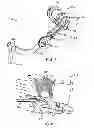 Fig. 06 - Modular exoskeletal force feedback controller