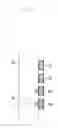 Fig. 04 - Electronic pen, electronic pen connection structure connecting to the electronic pen, and portable device having the electronic pen connection structure
