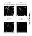 Fig. 07 - Imaging system and method for use in surgical and interventional medical procedures