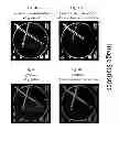 Fig. 08 - Imaging system and method for use in surgical and interventional medical procedures