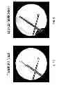 Fig. 09 - Imaging system and method for use in surgical and interventional medical procedures