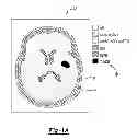 Fig. 03 - System and method for radio-frequency imaging, registration, and localization