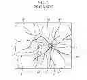 Fig. 02 - OCULAR FUNDUS INFORMATION ACQUISITION DEVICE, METHOD AND PROGRAM