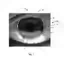 Fig. 08 - METHODS AND APPARATUSES FOR DETERMINING CONTACT LENS INTOLERANCE IN CONTACT LENS WEARER PATIENTS BASED ON DRY EYE TEAR FILM CHARACTERISTIC ANALYSIS AND DRY EYE SYMPTOMS