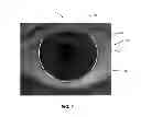 Fig. 09 - METHODS AND APPARATUSES FOR DETERMINING CONTACT LENS INTOLERANCE IN CONTACT LENS WEARER PATIENTS BASED ON DRY EYE TEAR FILM CHARACTERISTIC ANALYSIS AND DRY EYE SYMPTOMS