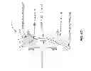 Fig. 45 - METHODS AND APPARATUSES FOR DETERMINING CONTACT LENS INTOLERANCE IN CONTACT LENS WEARER PATIENTS BASED ON DRY EYE TEAR FILM CHARACTERISTIC ANALYSIS AND DRY EYE SYMPTOMS