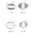 Fig. 06 - FLUID LENS ASSEMBLY