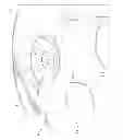 Fig. 15 - OPTIC OBSCURATION ASSEMBLY, METHOD AND SYSTEM FOR WORKING ON AN OPTICAL ELEMENT, AND RESULTING OPTICAL ELEMENT