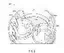 Fig. 03 - Device and method for coupling a light source to a printed circuit board in lamps