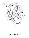 Fig. 02 - Earphones