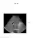 Fig. 07 - Apparatus and method for lesion segmentation and detection in medical images