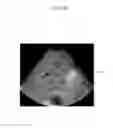 Fig. 08 - Apparatus and method for lesion segmentation and detection in medical images
