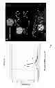 Fig. 09 - Method of analyzing a medical image