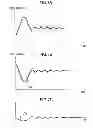 Fig. 08 - Image forming apparatus which controls fixing drive motor according to pressure roller diameter