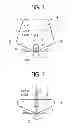 Fig. 02 - Fixing device