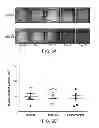 Fig. 10 - METHODS FOR TREATING UV-DAMAGED SKIN AND SCC TUMORS AND FOR REMOVING TATTOOS WITH TOPICAL INGENOL MEBUTATE