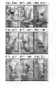 Fig. 15 - METHODS FOR TREATING UV-DAMAGED SKIN AND SCC TUMORS AND FOR REMOVING TATTOOS WITH TOPICAL INGENOL MEBUTATE