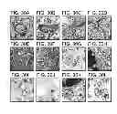 Fig. 32 - METHODS FOR TREATING UV-DAMAGED SKIN AND SCC TUMORS AND FOR REMOVING TATTOOS WITH TOPICAL INGENOL MEBUTATE