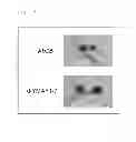Fig. 17 - METHODS AND COMPOSITION FOR TESTING, PREVENTING, AND TREATING ASPERGILLUS FUMIGATUS INFECTION