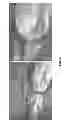 Fig. 08 - Graft for directed vascular and lymphatic regeneration and methods to guide endothelial cell assembly