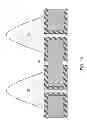 Fig. 04 - Two mask process for electroplating metal employing a negative electrophoretic photoresist