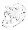 Fig. 01 - METHOD FOR ORTHODONTIC TREATMENT