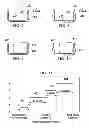 Fig. 07 - METHOD FOR ORTHODONTIC TREATMENT